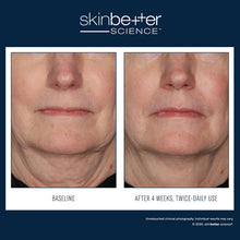 Load image into Gallery viewer, Interfuse Intensive Treatment Face & Neck