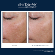 Load image into Gallery viewer, AlphaRet Overnight Cream