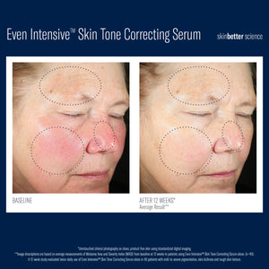 Even Intensive Skin Tone Correcting Serum